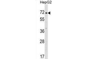 Western Blotting (WB) image for anti-Zinc Finger Protein 155 (ZNF155) antibody (ABIN2999111) (ZNF155 antibody)