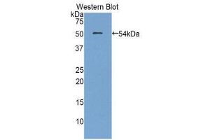 Western Blotting (WB) image for anti-Plasminogen Activator, Urokinase Receptor (PLAUR) (AA 15-211) antibody (FITC) (ABIN1860909) (PLAUR antibody  (AA 15-211) (FITC))
