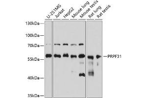 Western blot analysis of extracts of various cell lines, using PRPF31 antibody (ABIN6132996, ABIN6146262, ABIN6146264 and ABIN6221399) at 1:3000 dilution. (PRPF31 antibody  (AA 1-200))