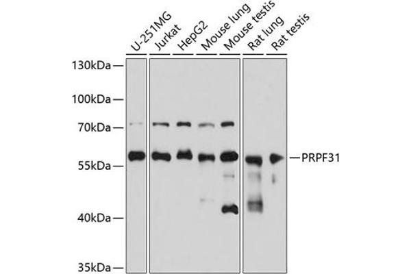 PRPF31 Antikörper  (AA 1-200)