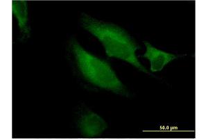 Immunofluorescence of monoclonal antibody to RAB9B on HeLa cell.