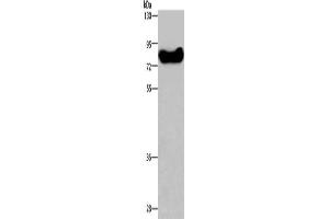 Gel: 8 % SDS-PAGE, Lysate: 40 μg, Lane: HepG2 cells, Primary antibody: ABIN7129183(DDX43 Antibody) at dilution 1/200, Secondary antibody: Goat anti rabbit IgG at 1/8000 dilution, Exposure time: 1 minute (DDX43 antibody)