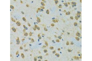 Immunohistochemistry of paraffin-embedded Rat brain using RPS7 Polyclonal Antibody at dilution of 1:100 (40x lens). (RPS7 antibody)