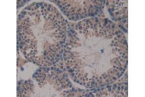Used in DAB staining on fromalin fixed paraffin- embedded Kidney tissue (NUP37 antibody  (AA 87-324))