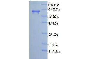 Calcium Activated Nucleotidase 1 (CANT1) (AA 80-397), (partial) protein (GST tag) (CANT1 Protein (AA 80-397, partial) (GST tag))