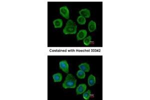ICC/IF Image Immunofluorescence analysis of methanol-fixed A431, using PTGFRN, antibody at 1:500 dilution.