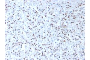 ABIN6383829 to WT1 was successfully used to stain nuclei in sections of human mesothelioma and in human and rat testis sections. (Recombinant WT1 antibody)