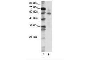 Image no. 1 for anti-Forkhead Box O1 (FOXO1) (N-Term) antibody (ABIN202855) (FOXO1 antibody  (N-Term))