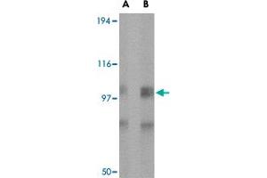 Western blot analysis of GRIK1 in rat brain tissue lysate with GRIK1 polyclonal antibody  at (A) 0. (GRIK1 antibody  (Internal Region))