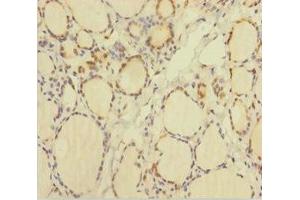 Immunohistochemistry of paraffin-embedded human thyroid tissue using ABIN7172031 at dilution of 1:100 (TXNL1 antibody  (AA 2-289))