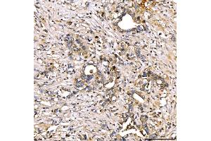 IHC analysis of Alpha 2 Antiplasmin/SERPINF2 using anti-Alpha 2 Antiplasmin/SERPINF2 antibody (ABIN7601808). (alpha 2 Antiplasmin antibody  (AA 461-491))