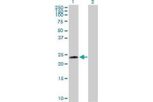 Western Blot analysis of UBE2T expression in transfected 293T cell line by UBE2T MaxPab polyclonal antibody. (Ube2t antibody  (AA 1-197))
