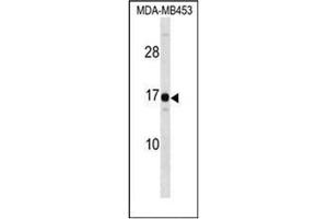 Western blot analysis of HMGN3 / TRIP7 Antibody (N-term) in MDA-MB453 cell line lysates (35ug/lane). (HMGN3 antibody  (N-Term))