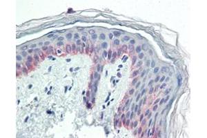 Immunohistochemical analysis of paraffin-embedded human skin tissues using CK5 mouse mAb. (Cytokeratin 5 antibody)