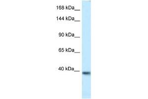 WB Suggested Anti-Kcnq2 Antibody   Titration: 1. (KCNQ2 antibody  (Middle Region))