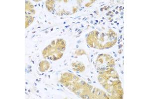 Immunohistochemistry of paraffin-embedded human stomach using UCHL3 antibody (ABIN5974797) at dilution of 1/100 (40x lens). (UCHL3 antibody)