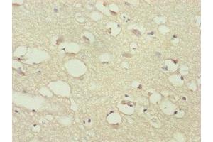 Immunohistochemistry of paraffin-embedded human brain tissue using ABIN7169284 at dilution of 1:100 (PPP2R3C antibody  (Regulatory Subunit B))