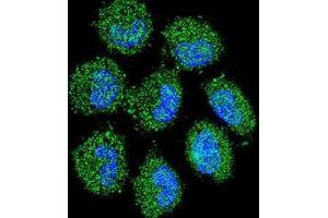 Confocal immunofluorescent analysis of PRAMEF6 Antibody (C-term)(Cat#AP53435PU-N) with NCI-H460 cell followed by Alexa Fluor 488-conjugated goat anti-rabbit lgG (green). (PRAMEF6 antibody  (C-Term))