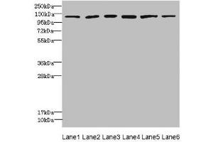 Western blot All lanes: UBE4A antibody at 2.