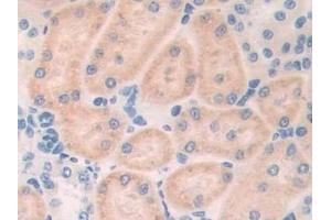 Detection of MYL6B in Rat Kidney Tissue using Polyclonal Antibody to Myosin Light Chain 6B, Alkali, Smooth Muscle And Non Muscle (MYL6B)