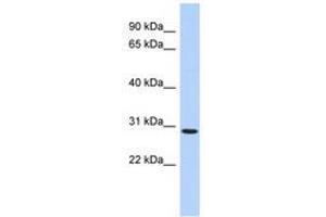 Image no. 1 for anti-SERTA Domain Containing 2 (SERTAD2) (AA 35-84) antibody (ABIN6741105) (SERTAD2 antibody  (AA 35-84))