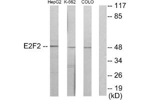 Western blot analysis of extracts from HepG2 cells, K562 cells and COLO205 cells, using E2F2 antibody. (E2F2 antibody  (Internal Region))