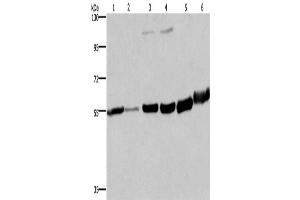 Western Blotting (WB) image for anti-Melanin-Concentrating Hormone Receptor 1 (MCHR1) antibody (ABIN2434978) (MCHR1 antibody)