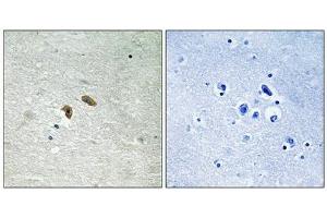 Immunohistochemical analysis of paraffin-embedded human brain tissue using C-RAF (Phospho-Thr269) antibody (left)or the same antibody preincubated with blocking peptide (right). (RAF1 antibody  (pThr269))