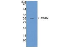 Detection of Recombinant SIRPa, Human using Polyclonal Antibody to Signal Regulatory Protein Alpha (SIRPa) (SIRPA antibody  (AA 105-324))