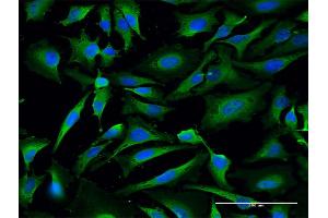 Immunofluorescence of purified MaxPab antibody to LDHA on HeLa cell. (Lactate Dehydrogenase A antibody  (AA 1-332))
