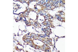 Immunohistochemistry of paraffin-embedded Human colon carcinoma using SLIRP Rabbit pAb (ABIN7270560) at dilution of 1:100 (40x lens). (SLIRP antibody  (AA 1-100))