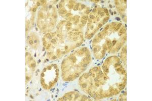 Immunohistochemistry of paraffin-embedded human kidney using ADCK3 antibody (ABIN5975514) at dilution of 1/100 (40x lens). (COQ8A antibody)