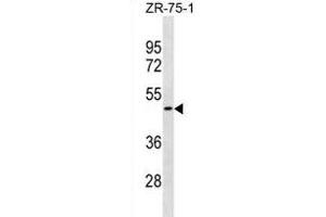 OR1S2 Antibody (C-term) (ABIN1881599 and ABIN2838716) western blot analysis in ZR-75-1 cell line lysates (35 μg/lane).