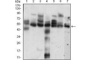 Western blot analysis using CCNE1 mouse mAb against Hela (1), K562 (2), NIH/3T3 (3), C6 (4), MCF-7 (5), Jurkat (6), A431 (7) cell lysate.