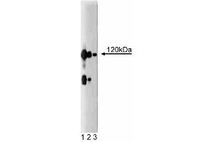 Western blot analysis of CASK on a rat cerebrum lysate. (CASK antibody  (AA 353-486))
