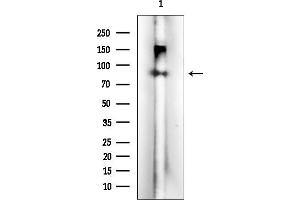 anti-Zinc Finger, FYVE Domain Containing 1 (ZFYVE1) antibody