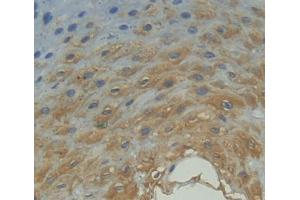 IHC-P analysis of esophagus tissue, with DAB staining. (FPGT antibody  (AA 127-377))