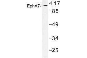 Image no. 1 for anti-EPH Receptor A7 (EPHA7) antibody (ABIN272234)