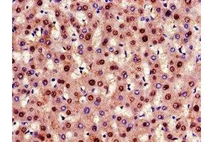Immunohistochemistry of paraffin-embedded human liver tissue using ABIN7153869 at dilution of 1:100 (Glucagon Receptor antibody  (AA 26-136))