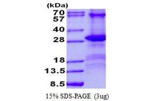 Image no. 1 for CD84 (CD84) protein (His tag) (ABIN1098688) (CD84 Protein (CD84) (His tag))