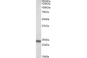 ABIN625812 (0. (GM2A antibody  (AA 164-175))
