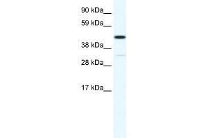 WB Suggested Anti-HOXA3 Antibody Titration:  1. (HOXA3 antibody  (N-Term))