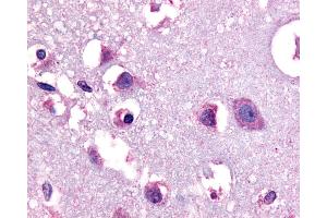 Anti-CRF1 antibody IHC of human human brain, neurons and glia. (CRHR1 antibody  (N-Term))