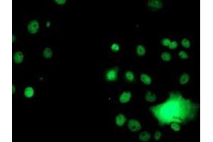 Anti-GSTT2 mouse monoclonal antibody (ABIN2453879) immunofluorescent staining of COS7 cells transiently transfected by pCMV6-ENTRY GSTT2 (RC200040). (GSTT2 antibody)