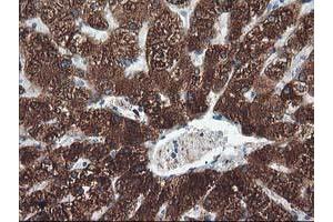 Immunohistochemical staining of paraffin-embedded Human liver tissue using anti-CYP2A6 mouse monoclonal antibody. (CYP2A6 antibody)
