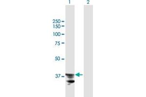 ADAM22 anticorps  (AA 1-342)