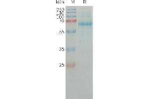 Plasminogen Activator, Tissue (PLAT) (AA 36-562) protein (His tag)