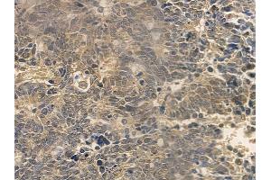 anti-Cyclin E2 (CCNE2) (C-Term) antibody