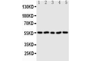 Anti-Syndecan 3 antibody, Western blotting Lane 1: U87 Cell Lysate Lane 2: 293T Cell Lysate Lane 3: PC-12 Cell Lysate Lane 4: NRK Cell Lysate Lane 5:  Cell Lysate