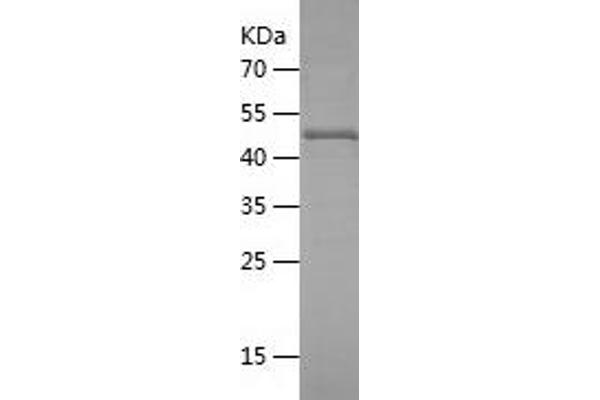 ALIX Protein (AA 1-239) (His-IF2DI Tag)